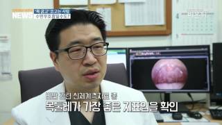 [기획취재] 수면무호흡 목둘레로 예측