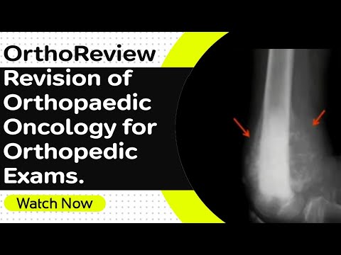 OrthoReview - Revision of Orthopaedic Oncology for Orthopedic Exams. Orthopaedic Academy