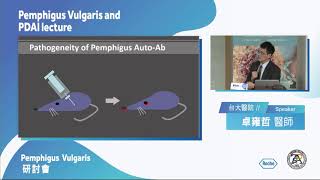 Pemphigus Vulgaris 醫學研討會-上半場