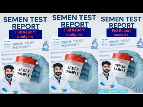 How to read semen test Report||#sperm #spermanalysis #labtechnician