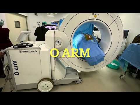 Fracture Dislocation Thoracic Spine: Advanced Hi-tech technology helps in excellent outcomes