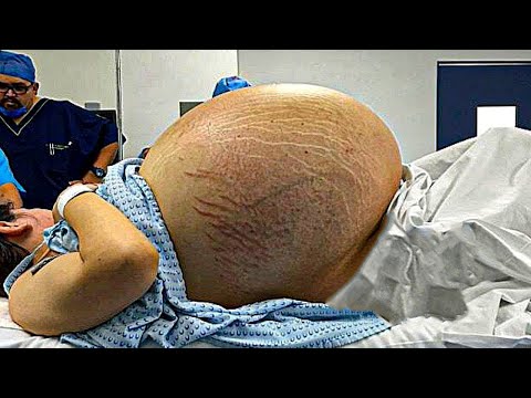 ELLE PENSE QU’ELLE VA AVOIR DES JUMEAUX : PUIS LE DOCTEUR DÉCOUVRE QUELQUE CHOSE D’INCROYABLE