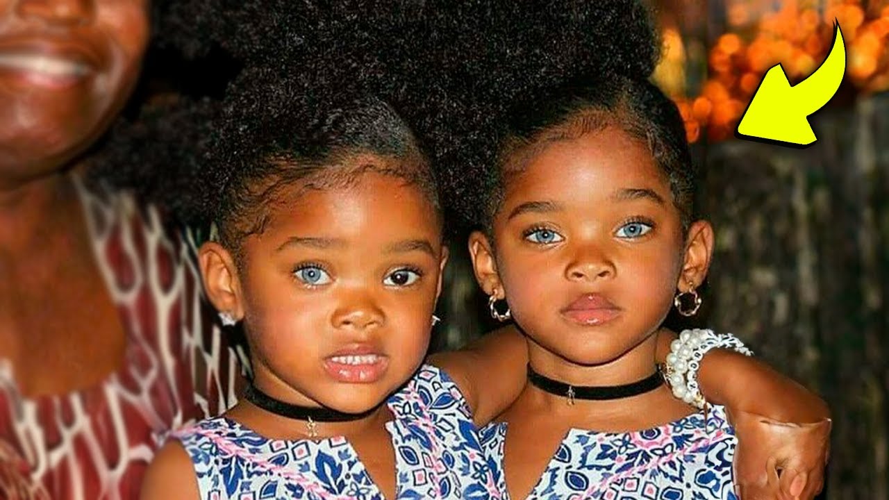 Lembra das Gêmeas Negras Mais Lindas do Mundo? Isso é o Que Aconteceu com Elas!