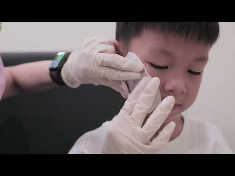 Laser Treatment in Children