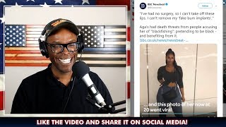 Blackfishing Instagram Honey Sent Threats For Trying To Look Black (REACTION)