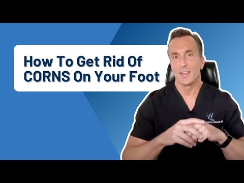 How Do You Get Rid Of Calluses Permanently