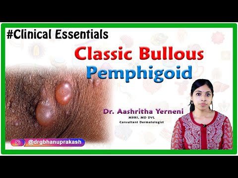 Classic bullous pemphigoid (Clinical essentials):  Dr. Aashritha yerneni