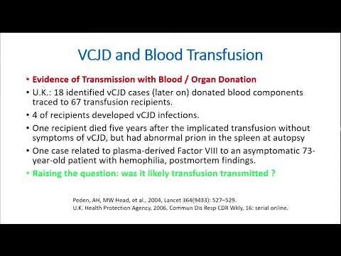 International Changes in Donor Elig. Criteria in Regards to Risks of HIVand CJD–Dr. Hanadi AlJedani
