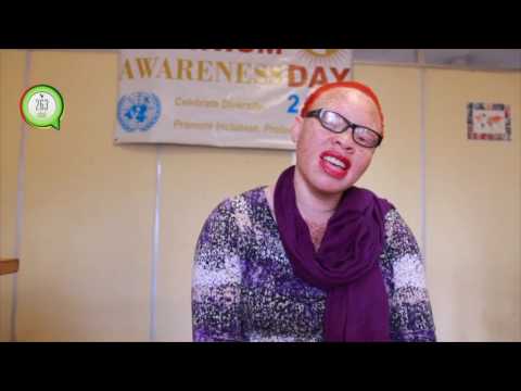 Alive Albinism Initiative giving hope to people with Albinism in Zimbabwe #263Chat