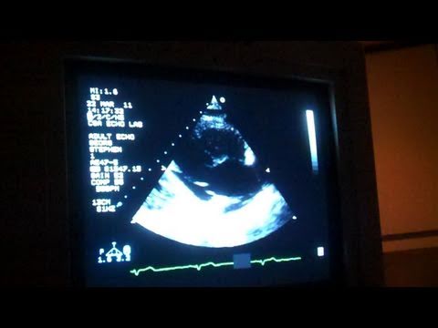 Check-Up (Day 483 - 3/22/11)