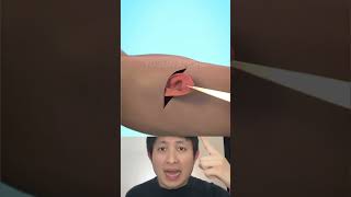 Download lagu GAK NYANGKA TELINGA BISA TUMBUH DALAM TANGAN MANUSIA ?! | Yosua Andre #shorts #facts #tipsandtricks mp3 Download lagu GAK NYANGKA TELINGA BISA TUMBUH DALAM TANGAN MANUSIA ?! | Yosua Andre #shorts #facts #tipsandtricks mp3