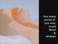 Understanding Cap and sleep apnea