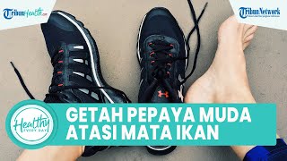 Download lagu Cara Menghilangkan Mata Ikan secara Alami, Salah Satunya dengan Getah Pepaya Muda mp3 Download lagu Cara Menghilangkan Mata Ikan secara Alami, Salah Satunya dengan Getah Pepaya Muda mp3