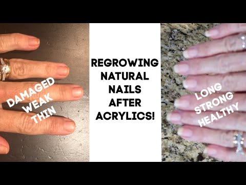 How To: Regrow Damaged Nails - Regrowing my NAILS after ACRYLICS