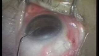 Dr. Howard Fine, Optomology