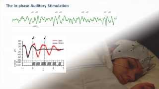Auditory Closed-Loop Stimulation of Sleep Slow Oscillations