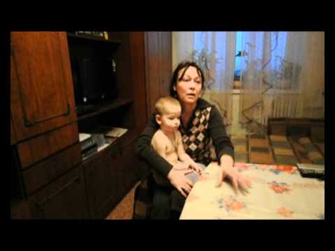 В Воронеже собака на глазах у детей порвала лицо 5-летней девочке