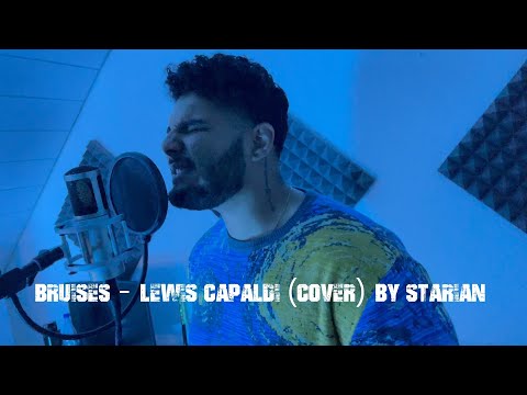 Bruises - Lewis Capaldi (cover) by Starian