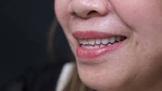 Chia sẻ của cô No Truong, khách hàng Việt kiều về Việt Nam điều trị tại Nha khoa Phương Thành