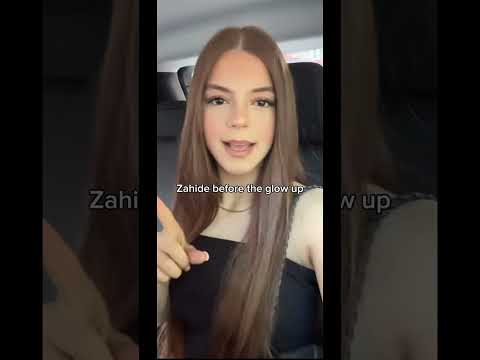 Zahide before the glow up💕 #zahide #edit #glowup