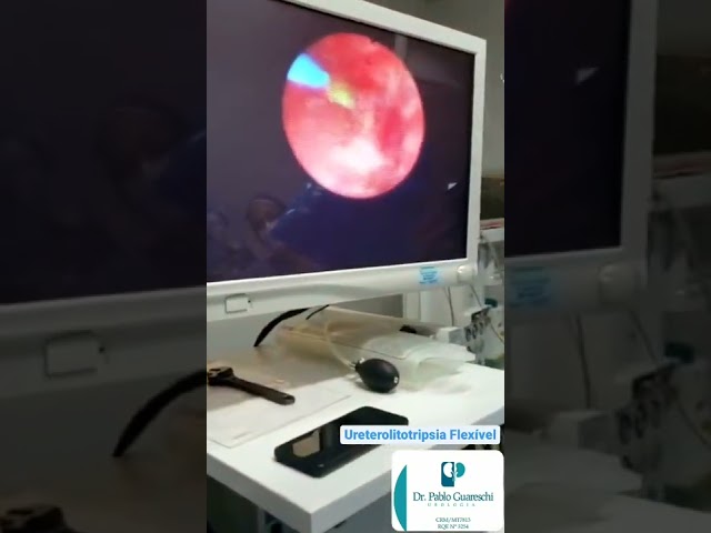 Vídeo