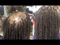 How To Grow Your Hair Back From Alopecia When You Have Locs Sister Locs Brother Locs