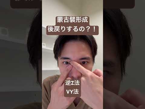医学科 蒙古襞形成は後戻りするのか？！