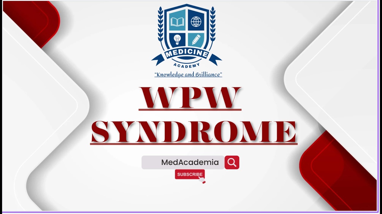 Wolff-Parkinson-White Syndrome for USMLE