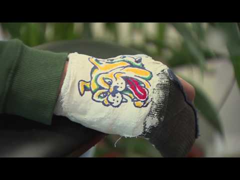 Kinderen krijgen tatoeage in ziekenhuis