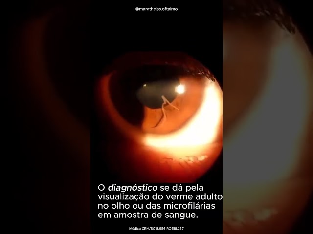 Vídeo