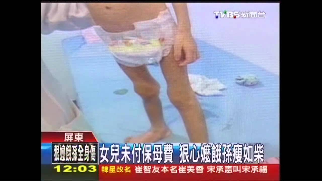女兒未付保母費 狠心嬤餓孫瘦如柴