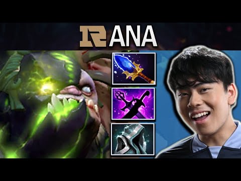 Pudge Dota 2 Gameplay RNG.Ana with 17 Kills and Epic High Health - Road to TI11