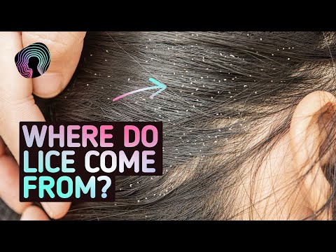 Your Body On Lice (Warning: Distressing Footage)