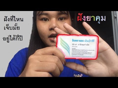 ยกเว้นผลิตภัณฑ์สำหรับกลาก โรคเบาหวาน, การรักษาโรคสะเก็ดเงิน