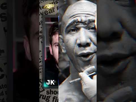 The Brutal Reality of UFC 306 Irene Aldana’s Devastating Injury