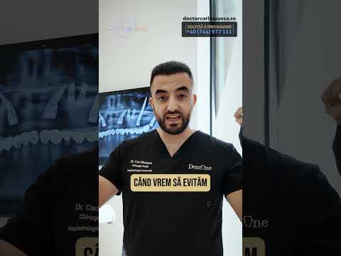 Implanturi dentare în cazuri complexe – soluții personalizate pentru situații dificile