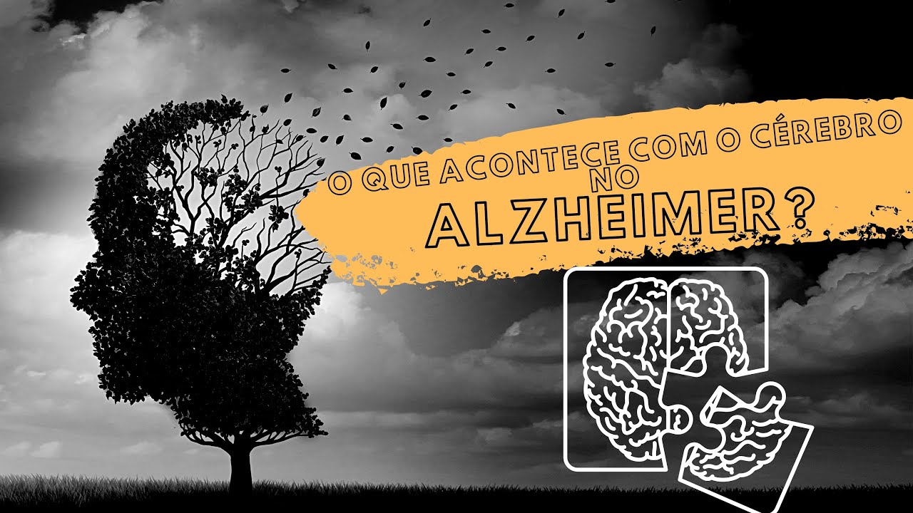 O que acontece com seu cérebro durante a Doença de Alzheimer?