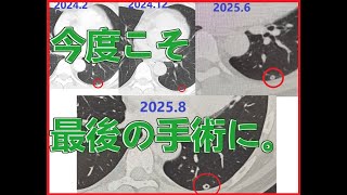 【大腸がんステージⅣ多発肝転移】5回目のがん切除手術！今度こそ溶解に期待！【現在闘病中㉗】