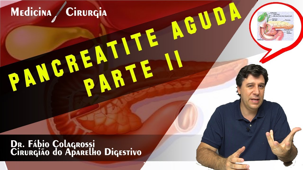 PANCREATITE AGUDA - CAUSAS AULA 2