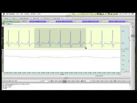 How to Sign Data Analysis in BSL