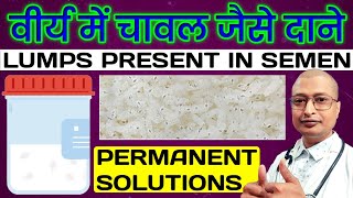 वीर्य में चावल जैसे दाने का Permanent Solution | वीर्य में गांठे गुठली का Treatment | Lumps In Semen