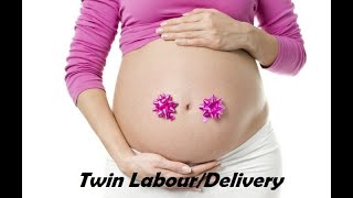 Normal Delivery of MCDA Twins/ Twin Labour or Delivery