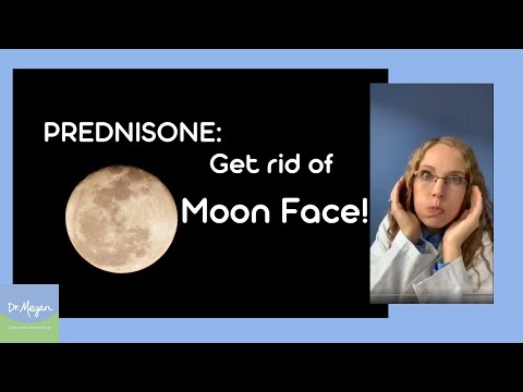 Moon 🌚 Face - How to Reduce 🌝 While on Prednisone 💊 (Side Effect)