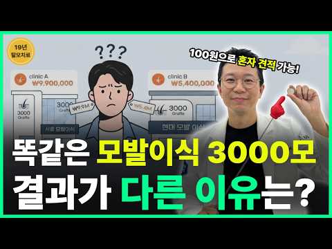 모발이식 2000모·3000모, 중요한 건 숫자보다 밀도입니다