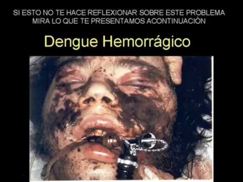 El Dengue - Aedes Aegyptis