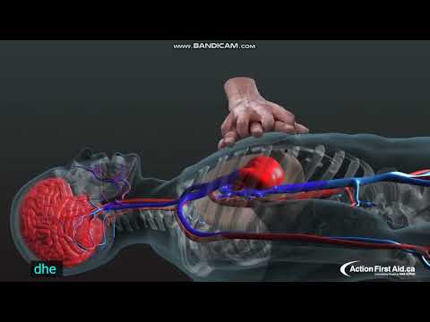 Ataku kardiak ( Ataku në zemër )