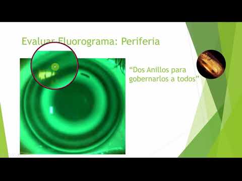 Certificación DRL 4. Fluorograma