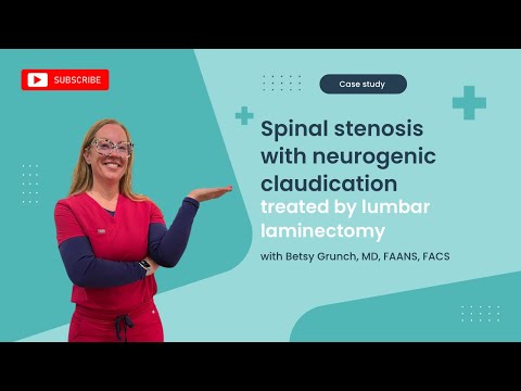 Case study 63- Lumbar degenerative spinal stenosis treated w/lumbar laminectomy explained by surgeon