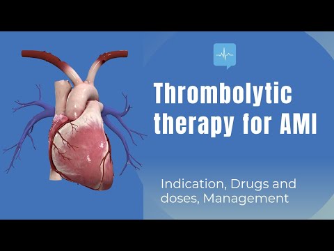 Thrombolytic therapy: Indication, treatment, drugs and management