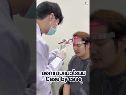 ปลูกผมเพิ่มความมั่นใจ ออกแบบไรผมพิเศษเฉพาะบุคคล